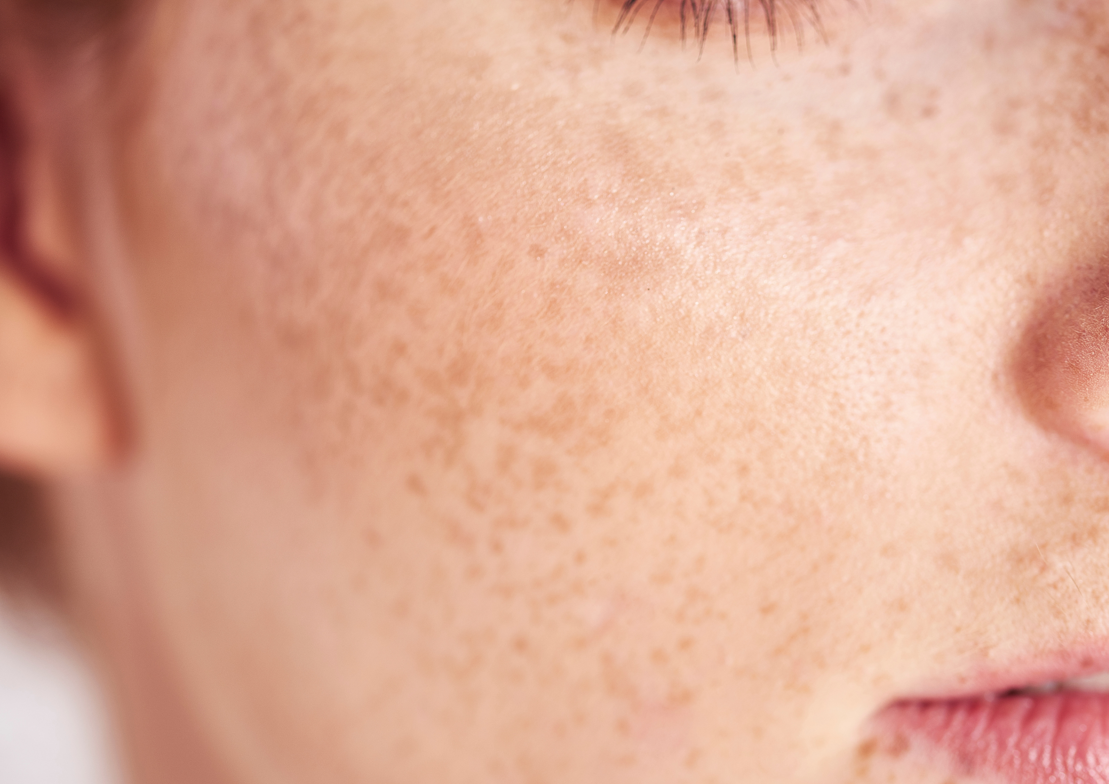 Up close picture of a women's cheek with freckles.