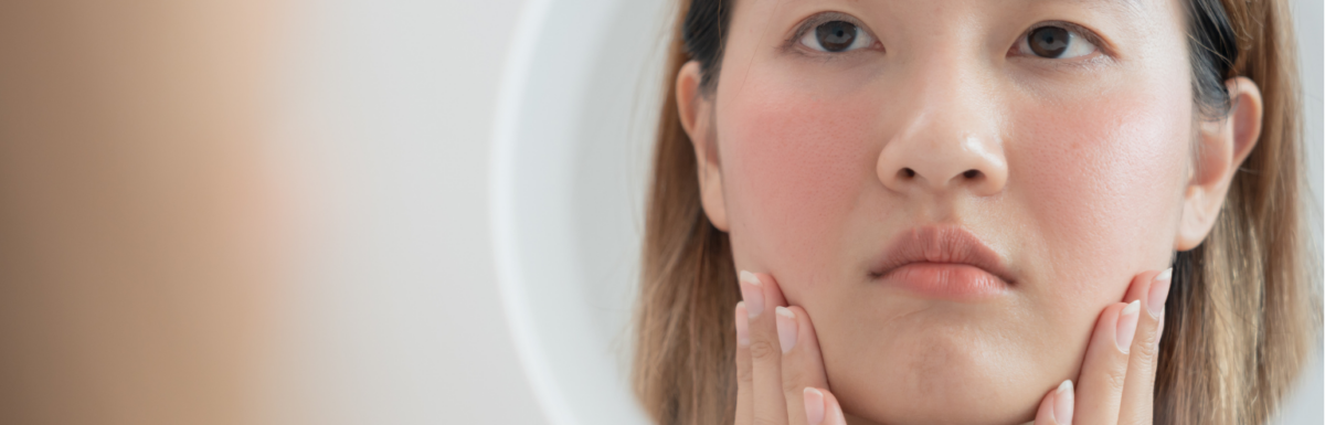 A Guide to Treating Facial Redness: From Rosacea to Reactions