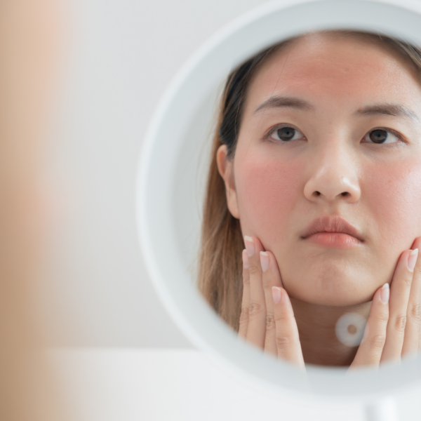 A Guide to Treating Facial Redness: From Rosacea to Reactions