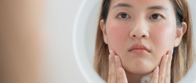 A Guide to Treating Facial Redness: From Rosacea to Reactions