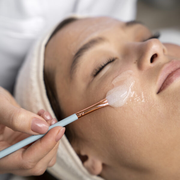 woman receiving a VI Peel from APDKC dermatologist
